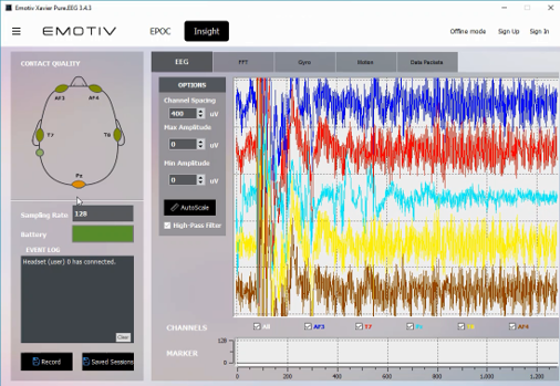 Нейрообследование: передача данных в систему